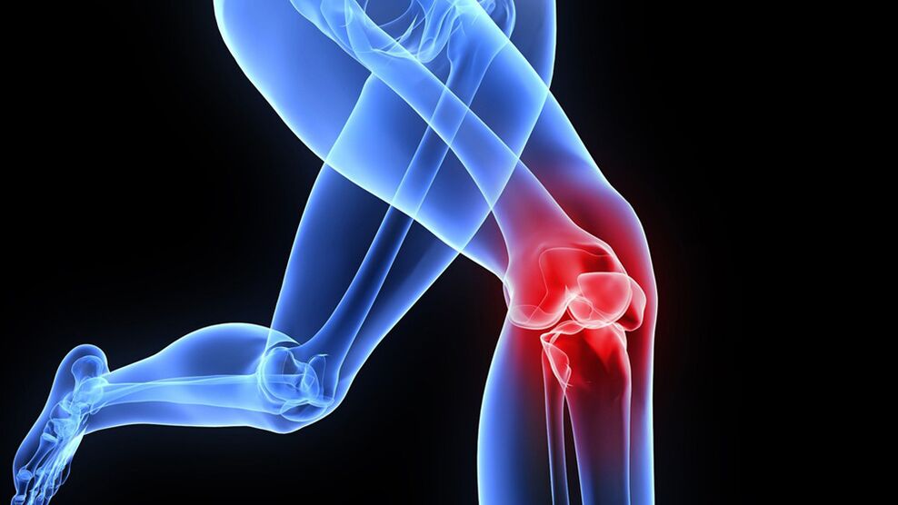 problèmes de genoux dus à l'arthrose